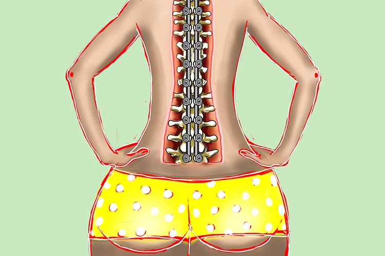 A mnemonic showing a verticle brace like vertebrate holding a human body upright